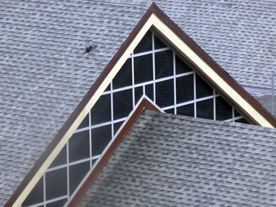 I`ve come down with a bad case of shingles.