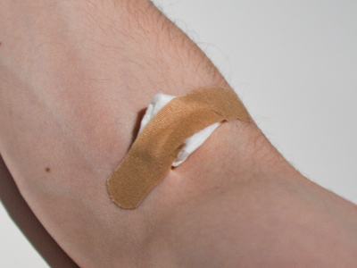 It probably should`ve healed by now (see October 8, 2008).