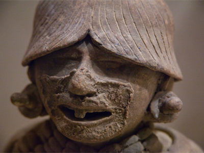 Phil discovers the harsh consequences of poor dental hygiene.