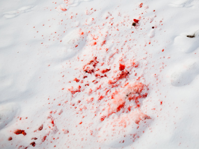 Snowblower accident.