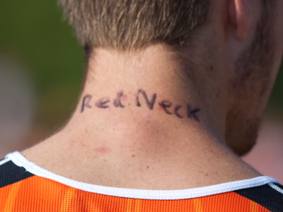 Sunscreen can help with that.