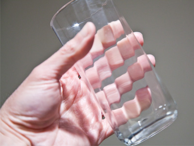 The extra knuckles in my fingers are often embarrassing.