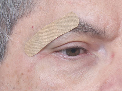 This is my second Band-Aid today.  The first was bigger.